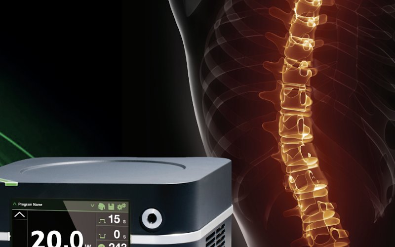 Ilustración de columna vertebral iluminada junto al equipo láser neoV para descompresión de disco