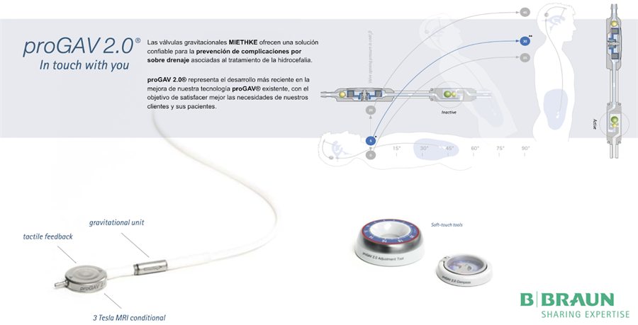 Válvula ajustable proGAV 2.0 con unidad gravitacional y herramienta de ajuste